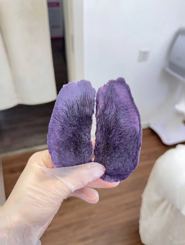 脱毛毛啦