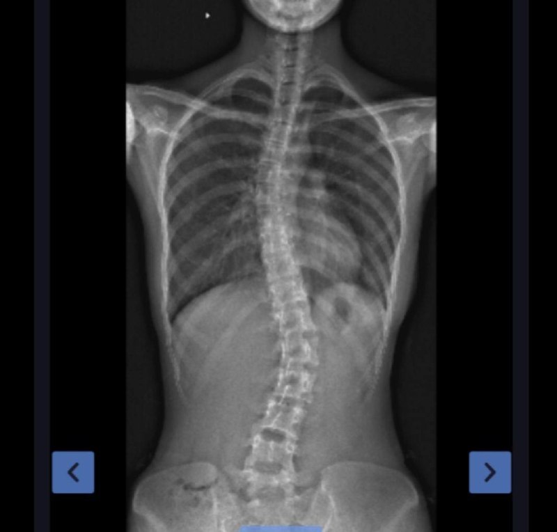 s型身材 露骨 照片 #内在美